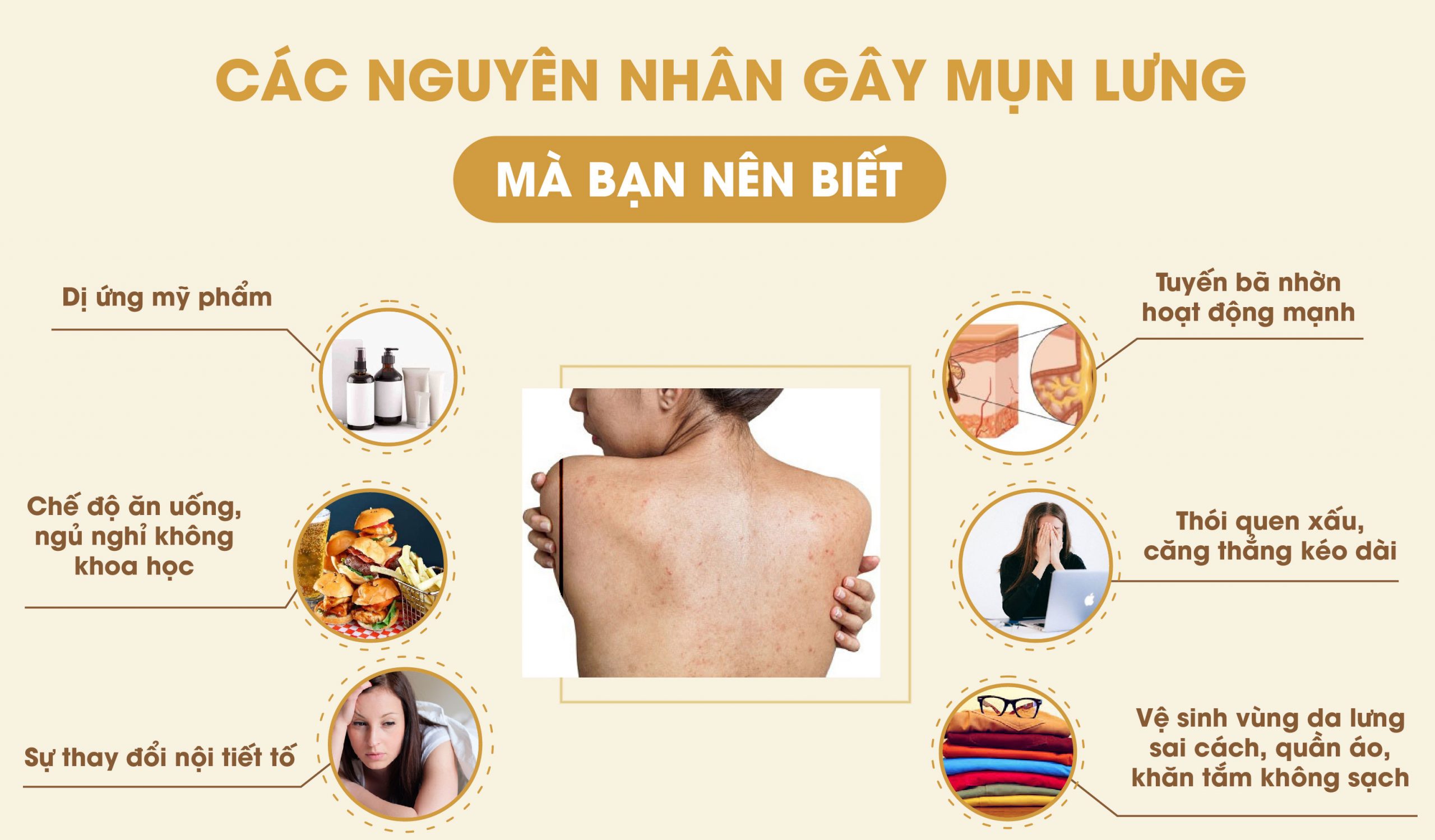 cách điều trị mụn lưng tại Nam Định