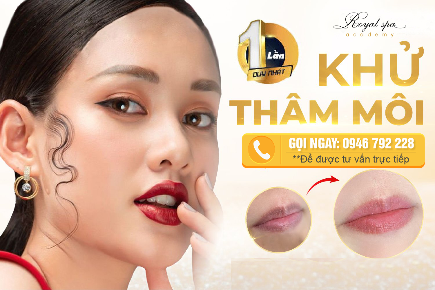 Khử thâm môi tại Nam Định của Royal Spa 