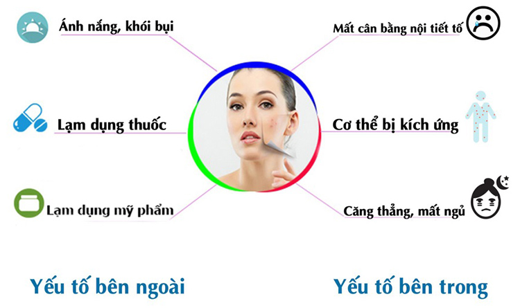Điều trị mụn tại Nam Định
