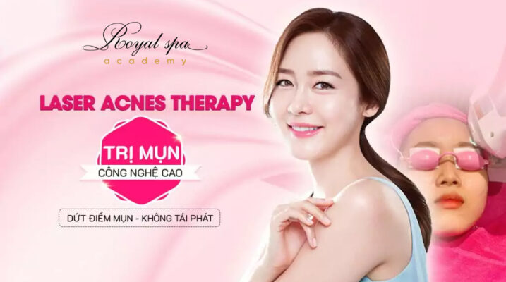 Liệu trình trị mụn tại Nam Định bằng công nghệ Laser Acne Therapy