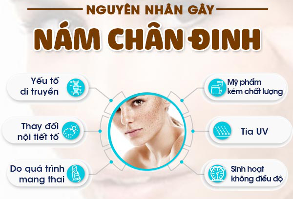 Spa điều trị Nám chân đinh tại Nam Định