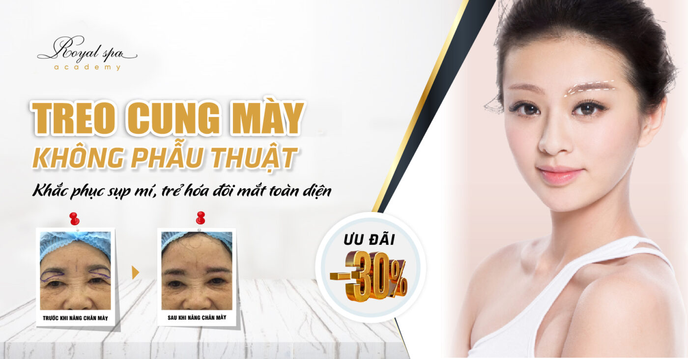 Treo cung mày tại Nam Định