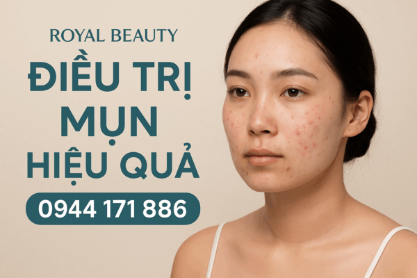 Điều trị mụn tại Nam Định
