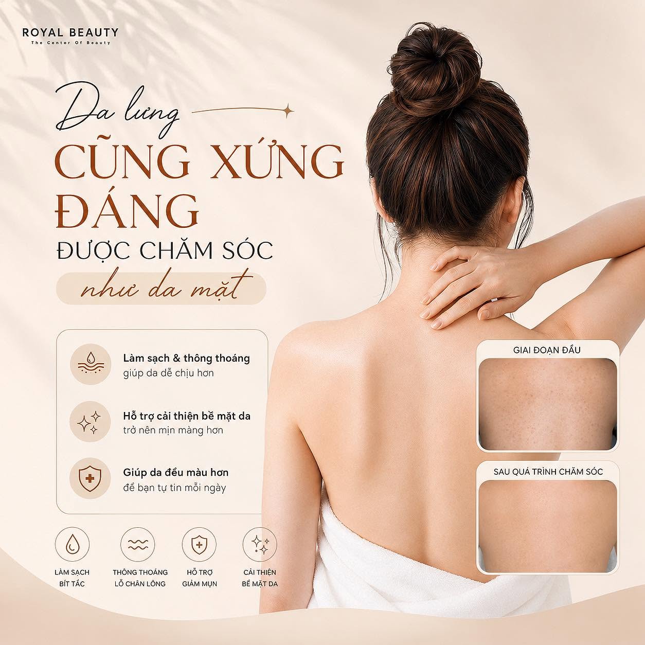 Chăm Sóc Da Lưng Tại Nam Định – Làn Da Lưng Cũng Xứng Đáng Được Quan Tâm | ROYAL BEAUTY