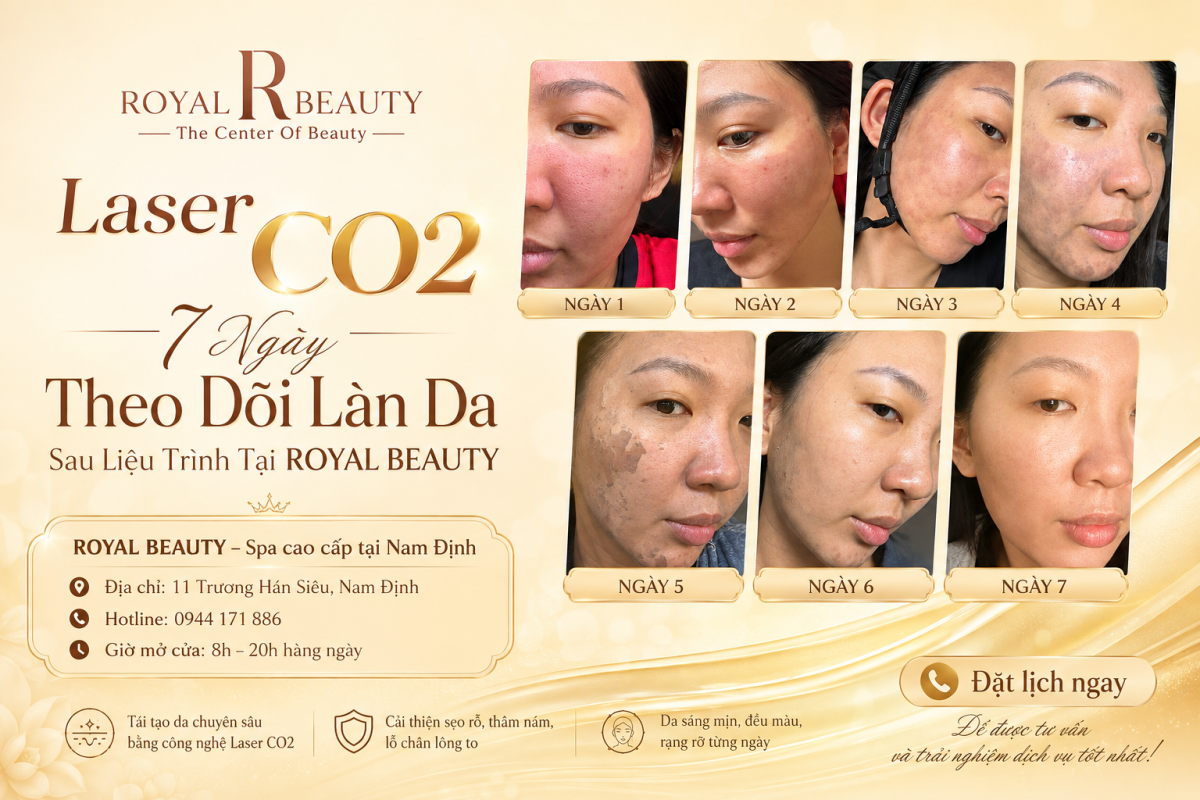 Laser CO2 tại Nam Định – 7 Ngày Theo Dõi Làn Da Sau Liệu Trình Tại ROYAL BEAUTY