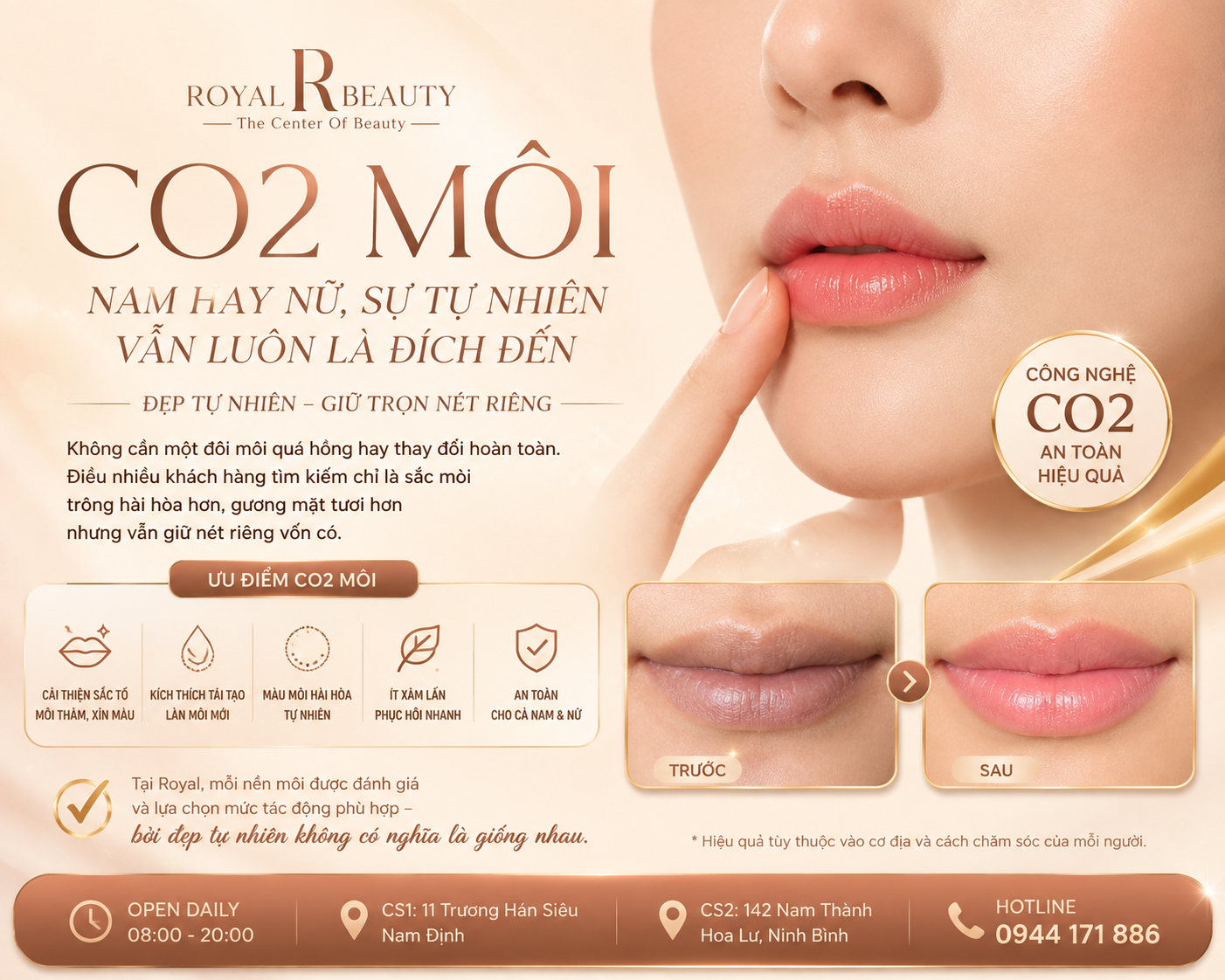 CO2 Môi tại Nam Định – Giải Pháp Cho Đôi Môi Tươi Tắn, Tự Nhiên