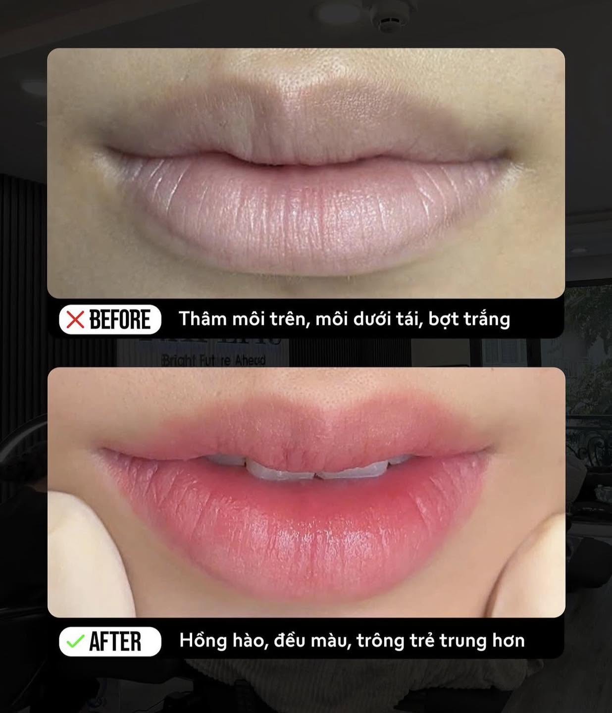 Phun Môi Tự Nhiên Tại Nam Định – Đẹp Rạng Rỡ Theo Cách Riêng Của Bạn