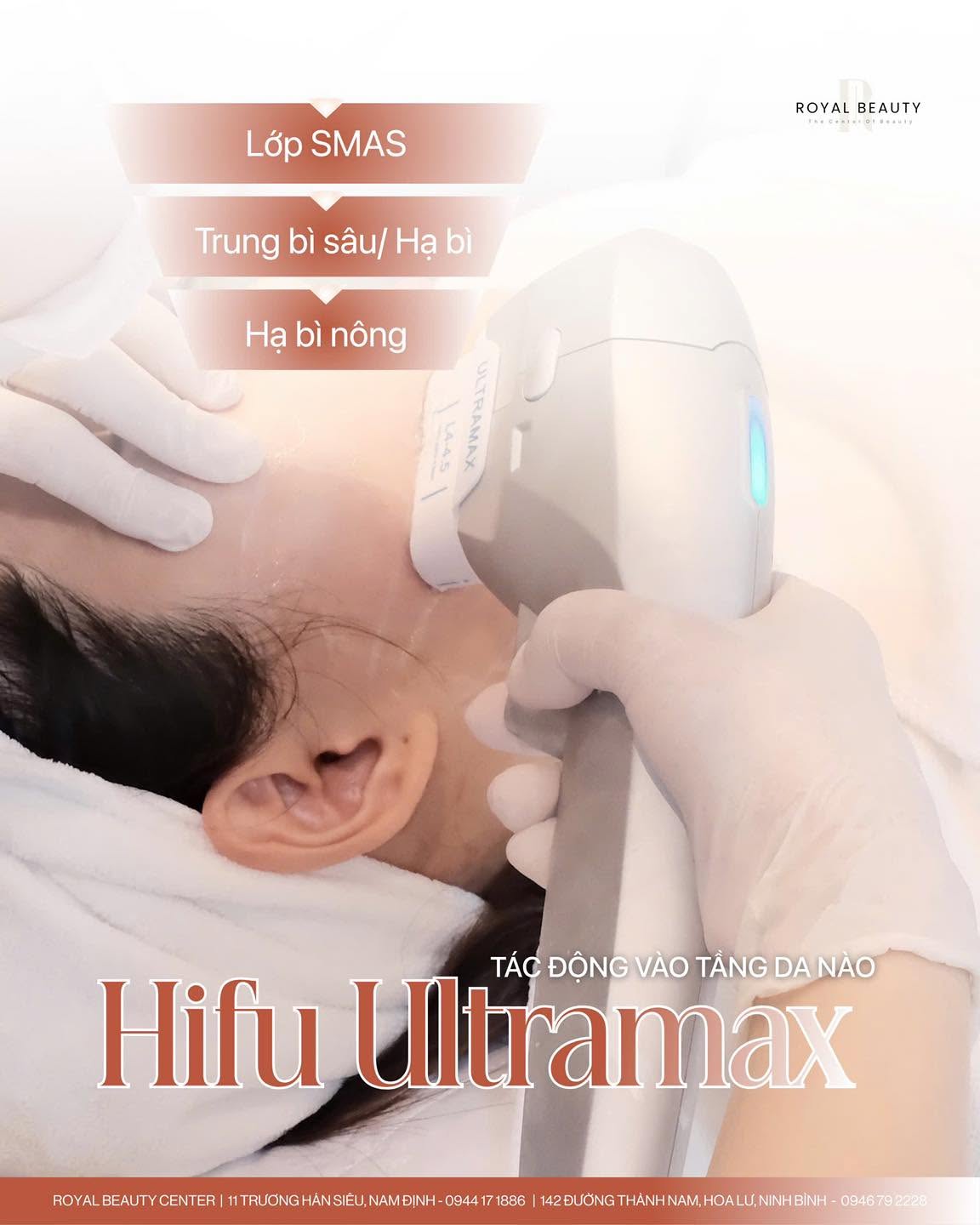 HIFU UltraMax Tại Nam Định – Công Nghệ Nâng Cơ Tác Động Đến Tầng SMAS