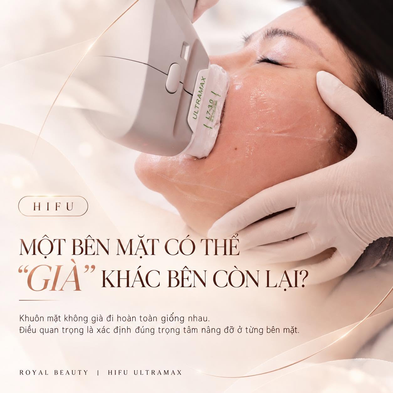 HIFU UltraMax – Hai Nửa Khuôn Mặt Không “Già” Giống Nhau