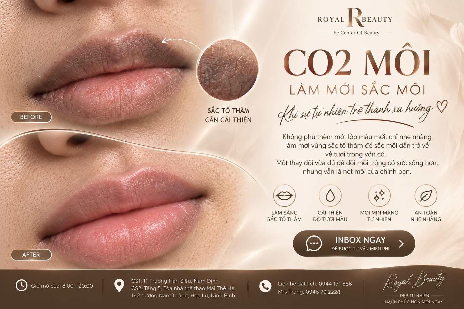 CO2 Môi Tại Nam Định – Làm Mới Sắc Môi Khi Vẻ Đẹp Tự Nhiên Trở Thành Xu Hướng