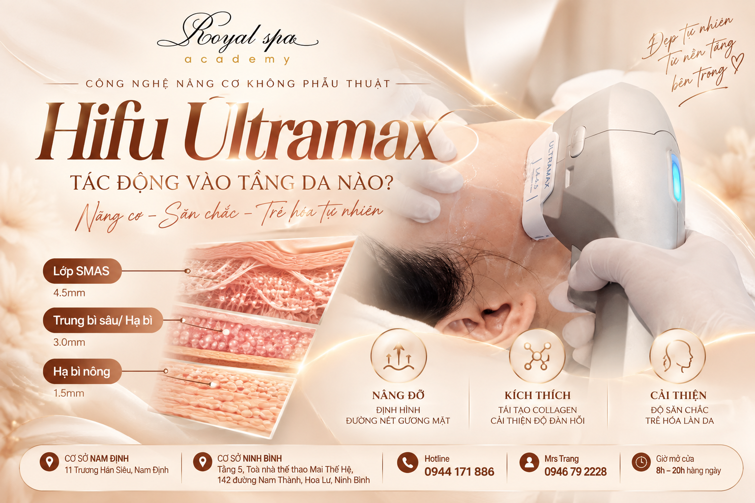 HIFU UltraMax Tại Nam Định – Công Nghệ Nâng Cơ Tác Động Đến Tầng SMAS