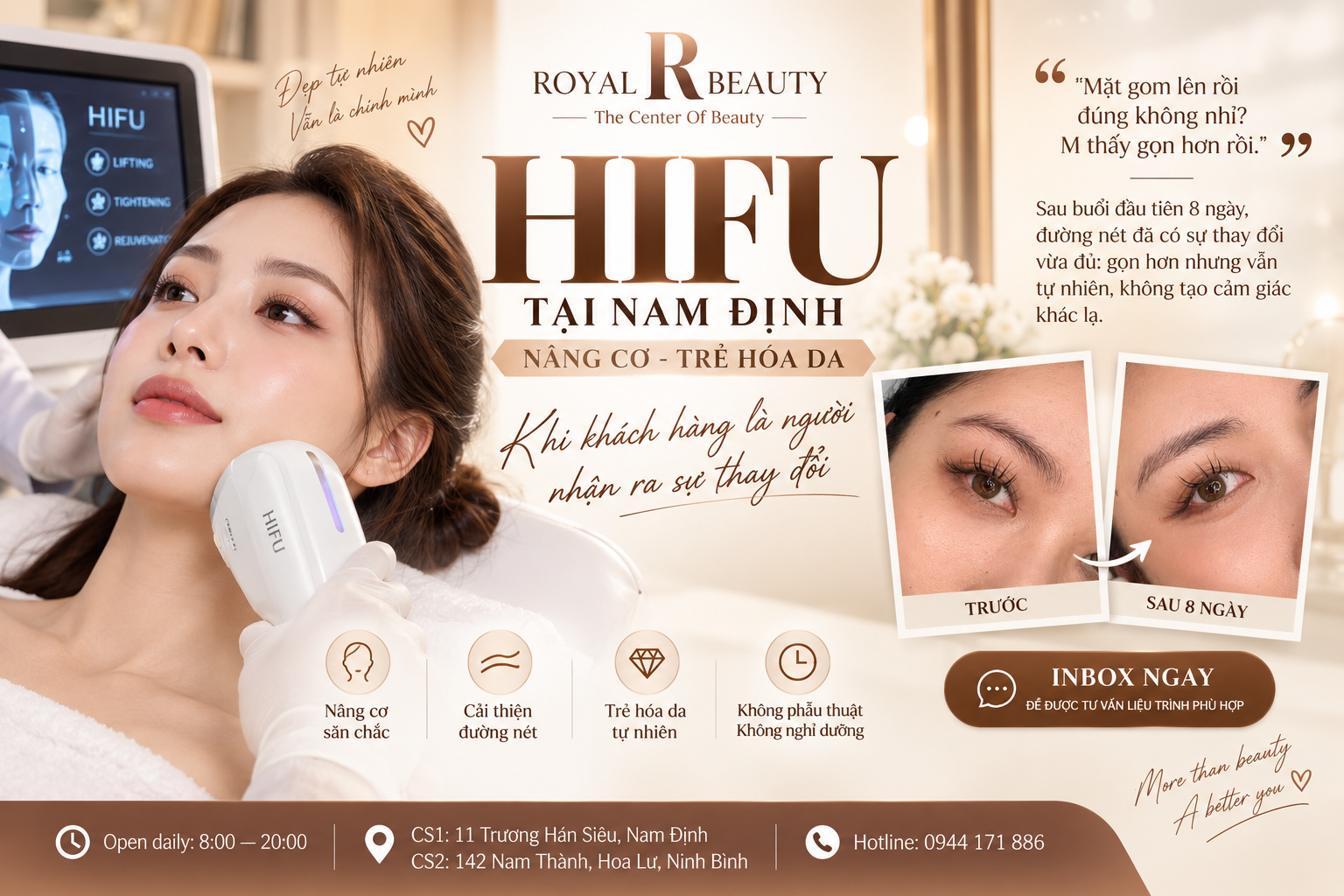 HIFU Tại Nam Định – Nâng Cơ Trẻ Hóa Da, Gương Mặt Gọn Hơn Theo Cách Tự Nhiên