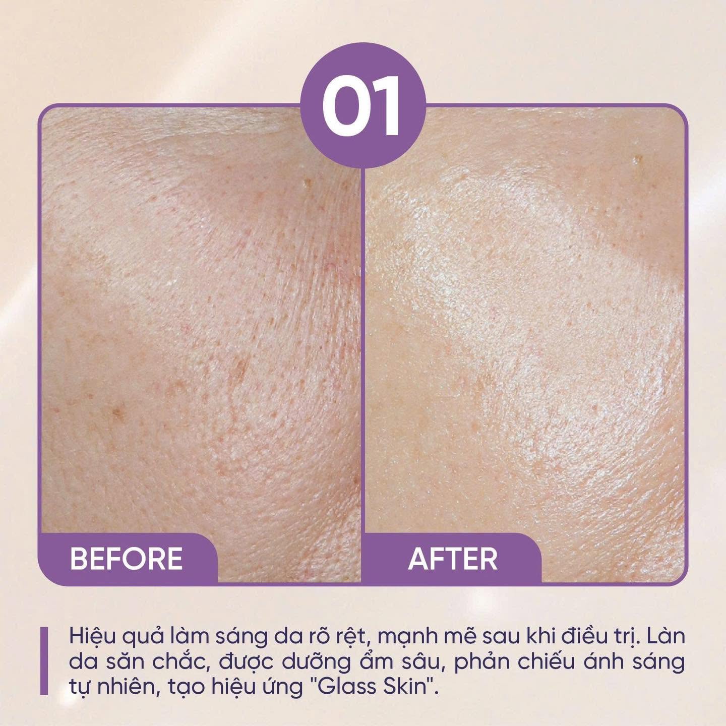 Glow & Glass Purlés – Chăm Sóc Da Căng Bóng Glass Skin | Royal Beauty