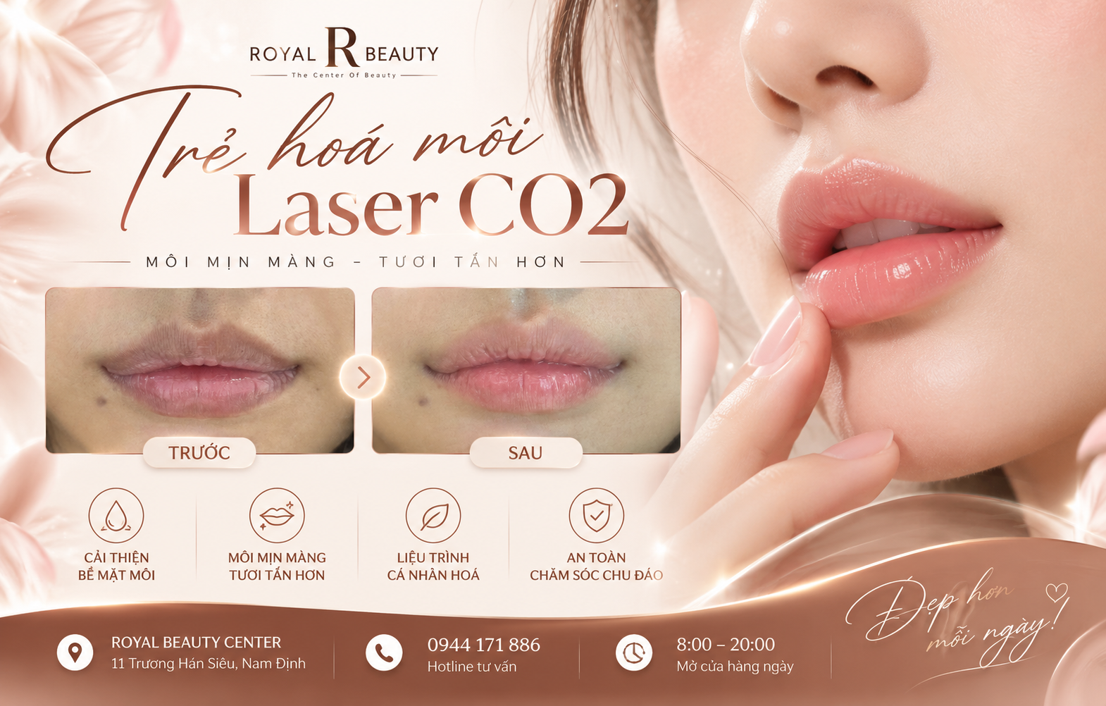 Trẻ Hóa Môi Bằng Laser CO₂ – Hành Trình Phục Hồi Và Trải Nghiệm Làm Đẹp Tại Royal Beauty