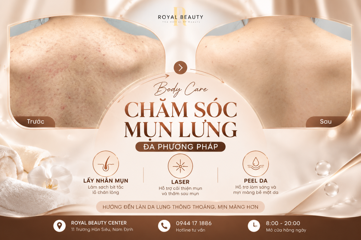 Body Care – Chăm Sóc Mụn Lưng Đa Phương Pháp Tại Royal Beauty