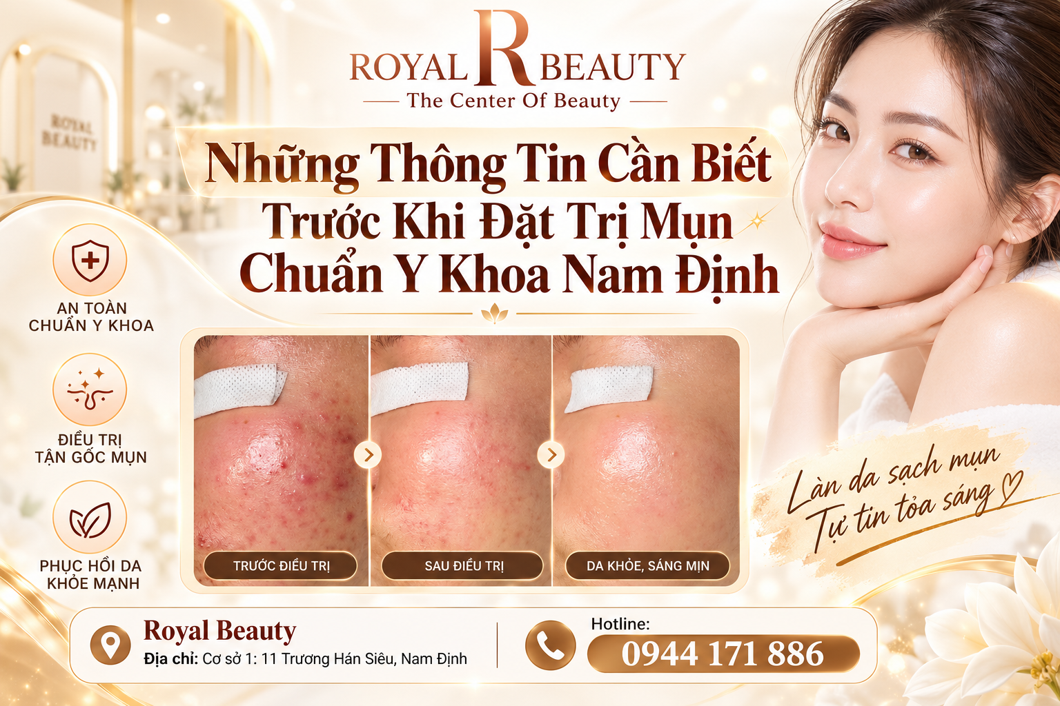 Những Thông Tin Cần Biết Trước Khi Đặt Trị Mụn Chuẩn Y Khoa Nam Định