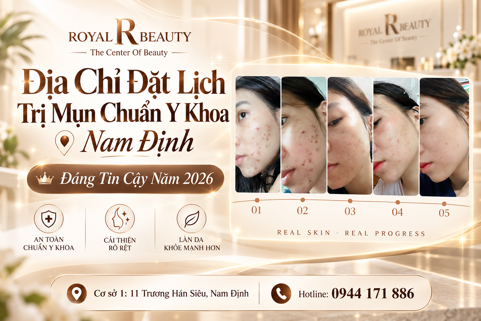 Địa Chỉ Đặt Lịch Trị Mụn Chuẩn Y Khoa Nam Định Đáng Tin Cậy Năm 2026