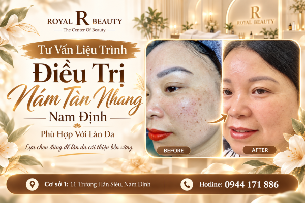 Tư Vấn Liệu Trình Điều Trị Nám Tàn Nhang Nam Định Phù Hợp Với Làn Da