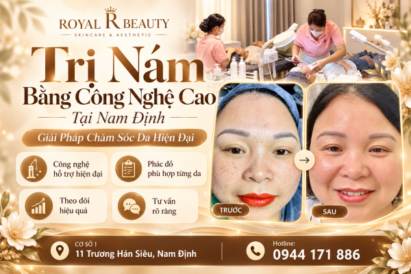 Trị Nám Bằng Công Nghệ Cao Tại Nam Định – Giải Pháp Chăm Sóc Da Hiện Đại