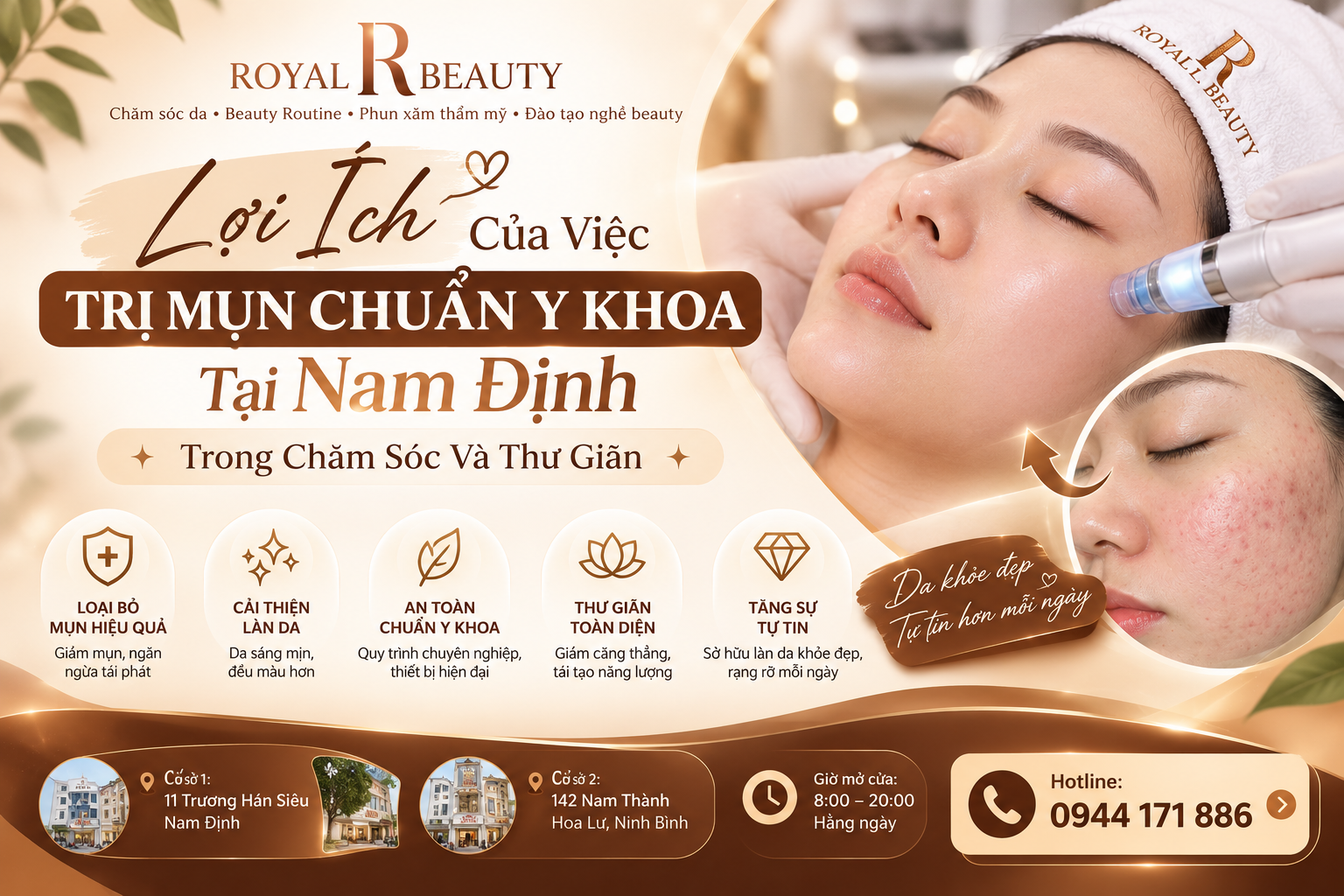 Lợi Ích Của Việc Trị Mụn Chuẩn Y Khoa Tại Nam Định Trong Chăm Sóc Và Thư Giãn