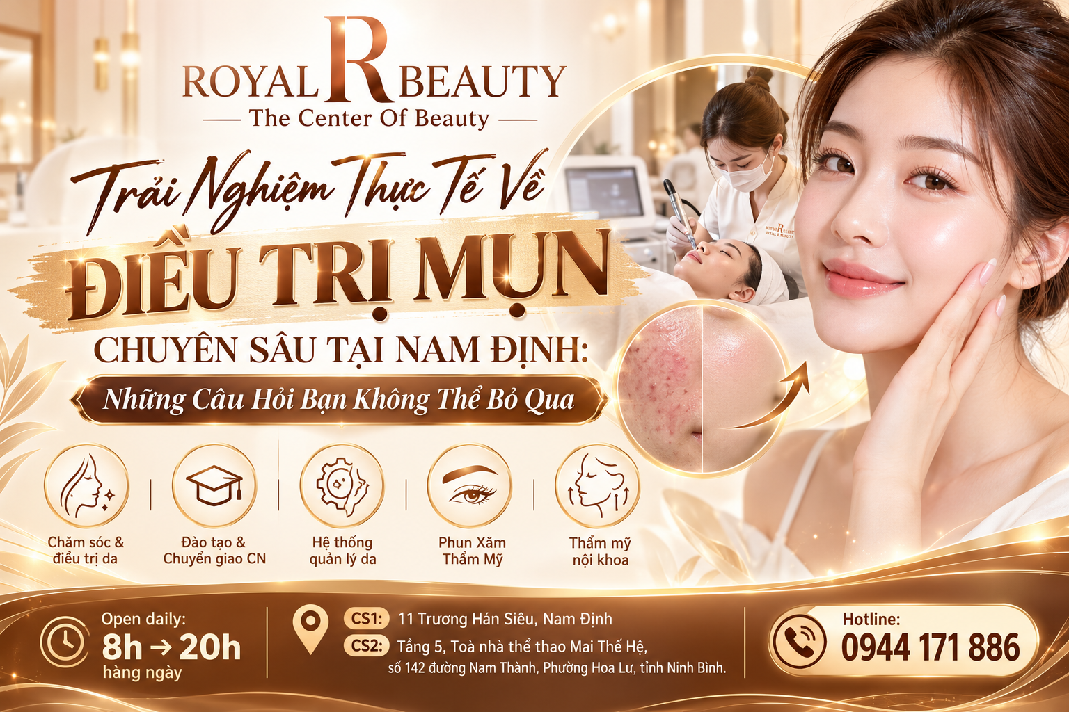 Trải Nghiệm Thực Tế Về Điều Trị Mụn Chuyên Sâu Tại Nam Định: Những Câu Hỏi Bạn Không Thể Bỏ Qua