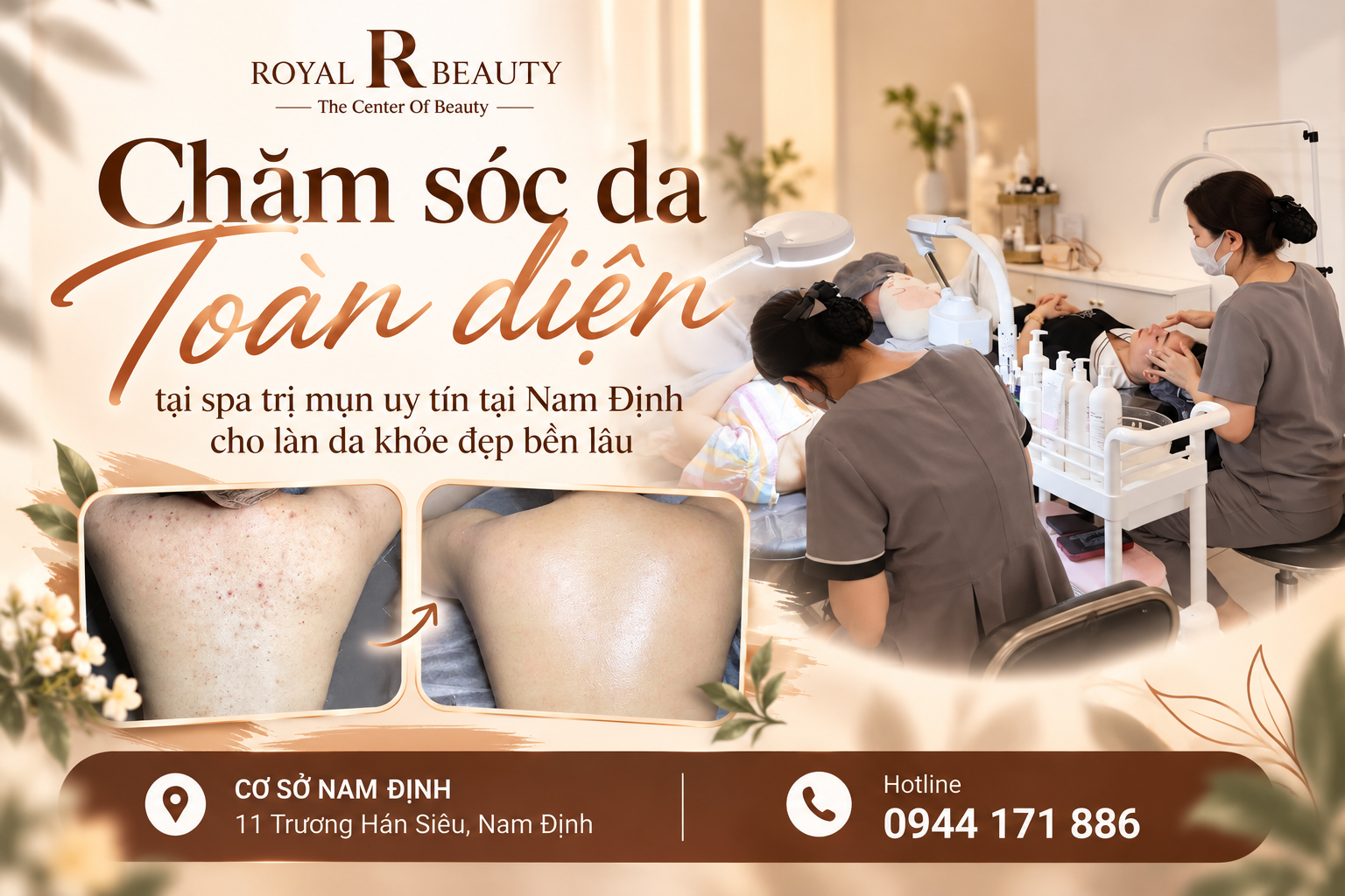Chăm sóc da toàn diện tại spa trị mụn uy tín tại Nam Định cho làn da khỏe đẹp bền lâu