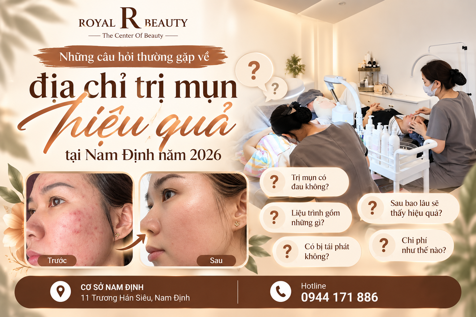 Những câu hỏi thường gặp về địa chỉ trị mụn hiệu quả tại Nam Định năm 2026