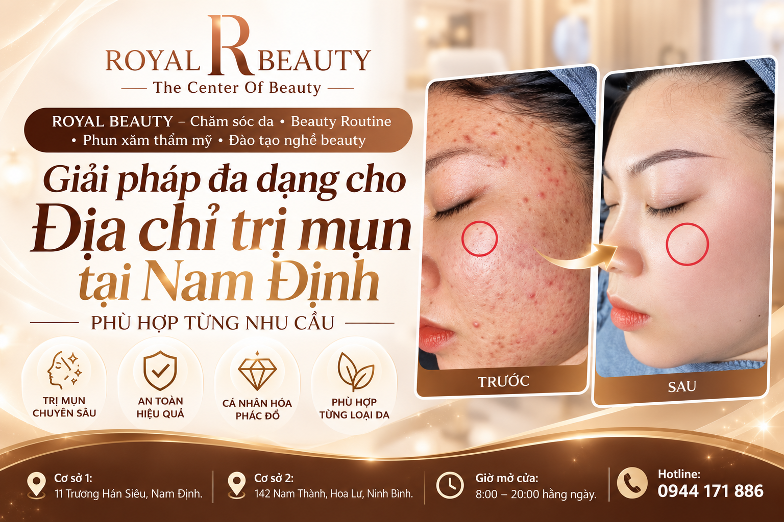 Giải pháp đa dạng cho Địa chỉ trị mụn tại Nam Định phù hợp từng nhu cầu