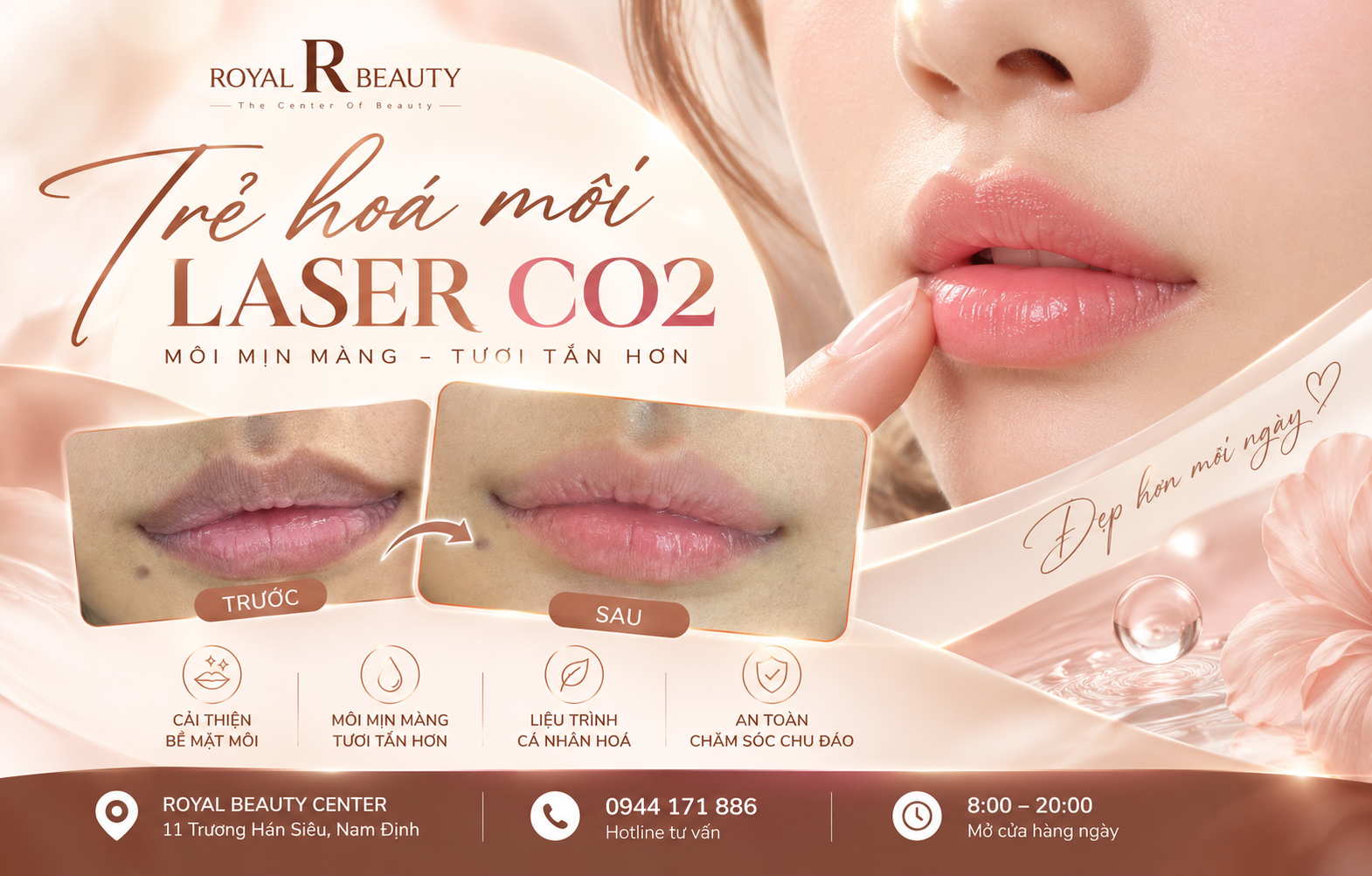 Trẻ Hóa Môi Bằng Laser CO₂ – Hành Trình Phục Hồi Và Trải Nghiệm Làm Đẹp Tại Royal Beauty
